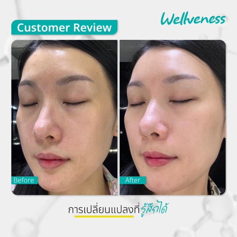 รีวิว Cucumis ผลลัพธ์ Cucumis รีวิว Niobright