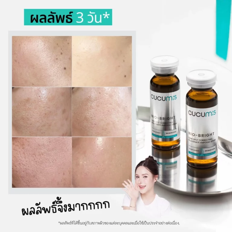 ก่อนใช้ หลังใช้ Cucumis Nio-Bright Ampoule Serum Cucumis รีวิว, Cucumis แอมพูลหน้าใส, การทำงานของผลิตภัณฑ์ cucumis, การเปรียบเทียบ cucumis กับแบรนด์อื่น, การเปรียบเทียบผลิตภัณฑ์ cucumis, การเลือกผลิตภัณฑ์ cucumis ที่เหมาะสม, ข้อมูลเกี่ยวกับผลิตภัณฑ์ cucumis, ความคิดเห็นเกี่ยวกับ cucumis, คำแนะนำสำหรับการใช้ cucumis, คำแนะนำในการใช้ cucumis, ประสบการณ์จากการใช้ cucumis, ประโยชน์ของการใช้ cucumis, ผลข้างเคียงของ cucumis, ผลลัพธ์จากการรีวิว cucumis, ผลลัพธ์จากการใช้ cucumis, ผลลัพธ์ที่คาดหวังจาก cucumis, ผลิตภัณฑ์ cucumis ดีหรือไม่, รีวิวการใช้งาน cucumis โดยผู้ใช้จริง, รีวิวการใช้งานผลิตภัณฑ์ cucumis, รีวิวจริงจากผู้ใช้ Cucumis, รีวิวจากบล็อกเกอร์เกี่ยวกับ cucumis, รีวิวจากผู้เชี่ยวชาญ cucumis, รีวิวจากผู้ใช้cucumis, รีวิวจากแหล่งที่เชื่อถือได้เกี่ยวกับ cucumis, รีวิวผลิตภัณฑ์ cucumis, รีวิวผลิตภัณฑ์ cucumis ที่ดีที่สุด, รีวิวผลิตภัณฑ์ cucumis ราคา, รีวิวผลิตภัณฑ์ cucumis สำหรับผิว, รีวิวผลิตภัณฑ์ cucumis และส่วนผสม, รีวิวผลิตภัณฑ์ cucumis ในประเทศไทย, รีวิวผลิตภัณฑ์ cucumis ใหม่ล่าสุด, วิธีการใช้ cucumis เพื่อผลลัพธ์ที่ดี, วิธีดูแลผิวด้วย cucumis, วิธีใช้ผลิตภัณฑ์ cucumis, สรุปการรีวิวผลิตภัณฑ์ cucumis