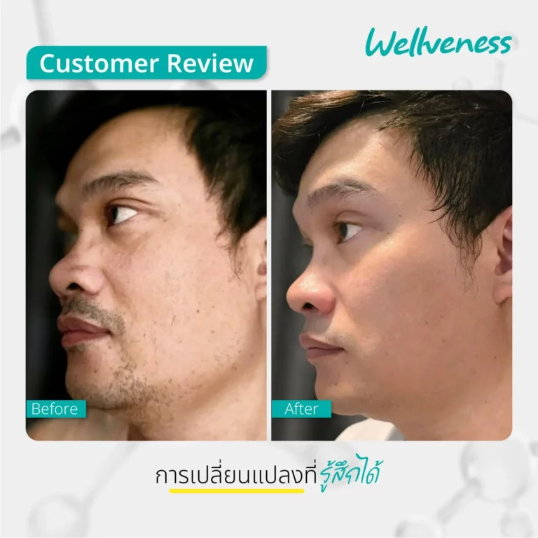 รีวิวผู้ชาย ใช้ cucumis จาก wellveness