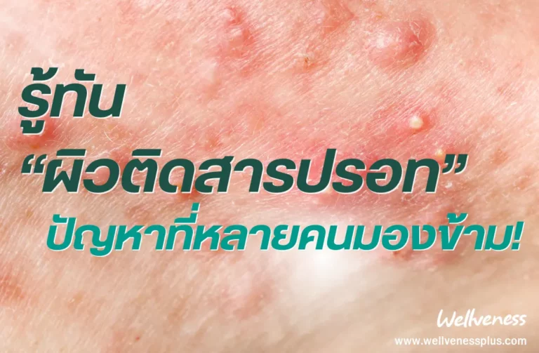 รู้ทัน ผิวติดสารปรอท ปัญหาที่หลายคนมองข้าม