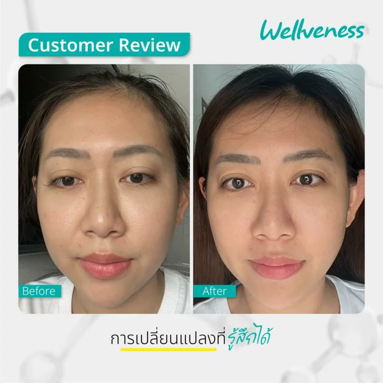 รีวิว ก่อนใช้-หลังใช้ Cucumis By Wellveness Before-After 0013